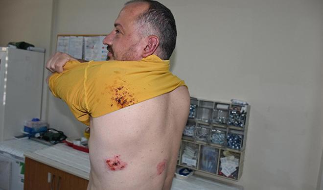 Ünlü gezgine sopalı saldırı Ünlü gezgine sopalı saldırı