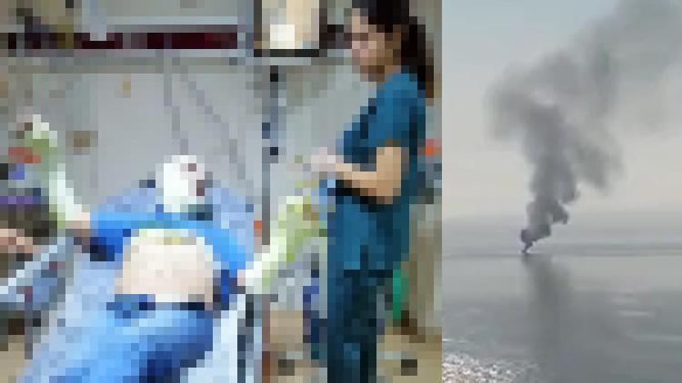 MHP İlçe Başkanı teknede çıkan yangında yaralandı