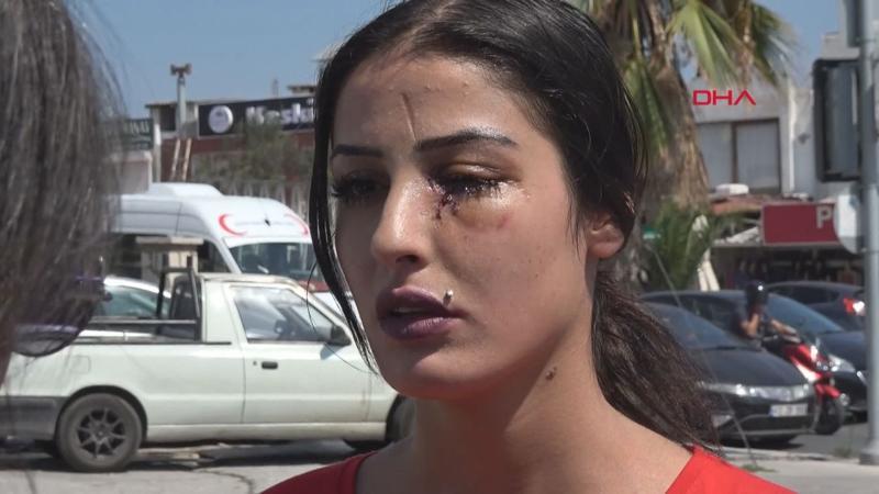 Eski eşinden şiddet gördüğünü ileri süren Beste Sözlü yardım istedi
