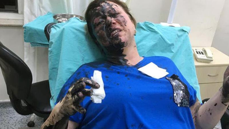 Genç kadını darp edip, üzerine siyah renkli sıvı madde döktüler