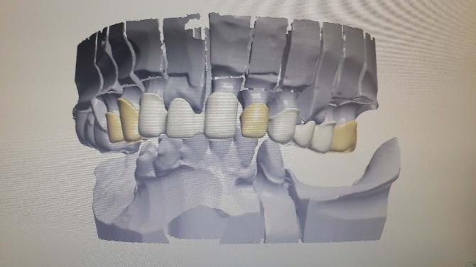 Dis Laboratuvarlari Icin Cad Cam Donanimi Dentsply Sirona