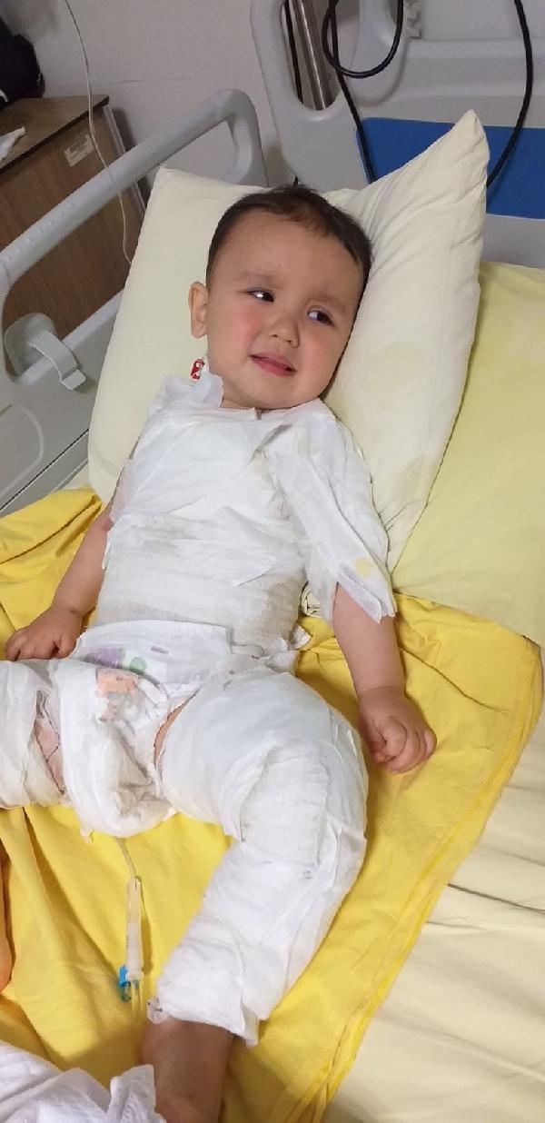 Dereli Haberleri Kaynar süt kazanına düşen Ömer bebek