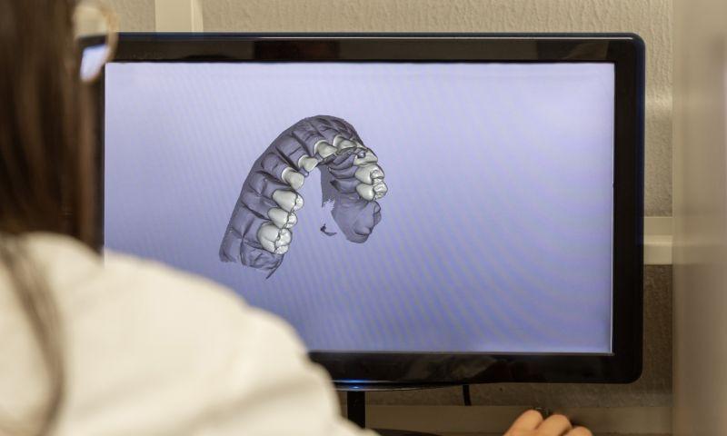 Cad Cam Dis Protez Uygulamalari Dental Tedaviler