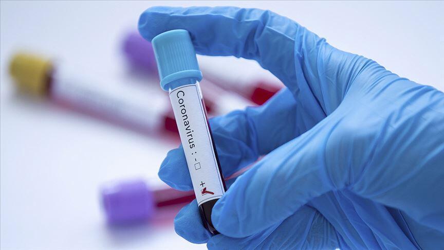 Εντοπίστηκαν 41 νέες περιπτώσεις coronavirus στο TRNC