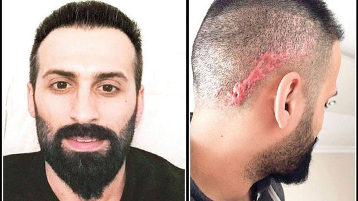 Sac Ekimi Istedi Kafasinda Bu Cikti Son Dakika Haberleri Internet