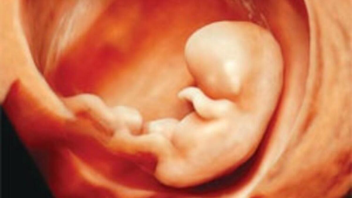 fetus nedir iste bebegin anne karninda gelisim asamalari
