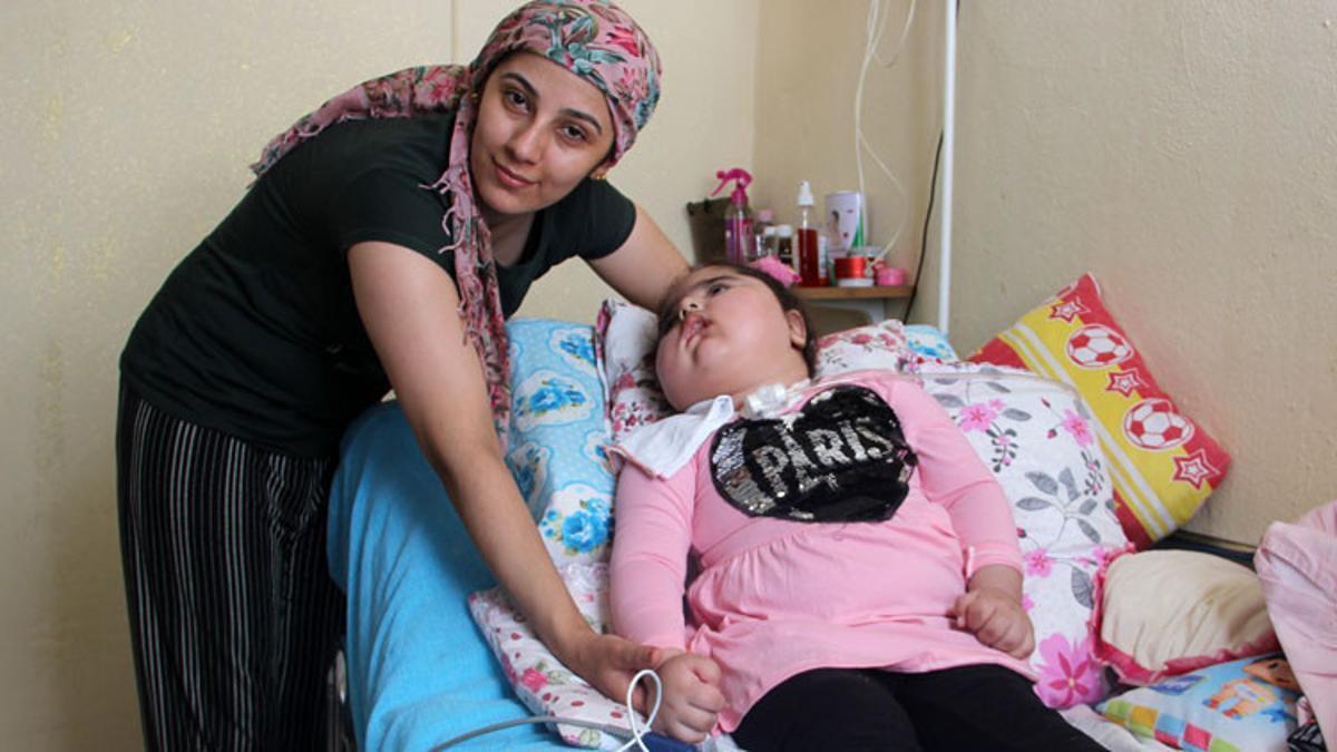 Bitkisel hayata giren minik kızının yeniden koşup oynamasını istiyor Son Dakika Haberleri