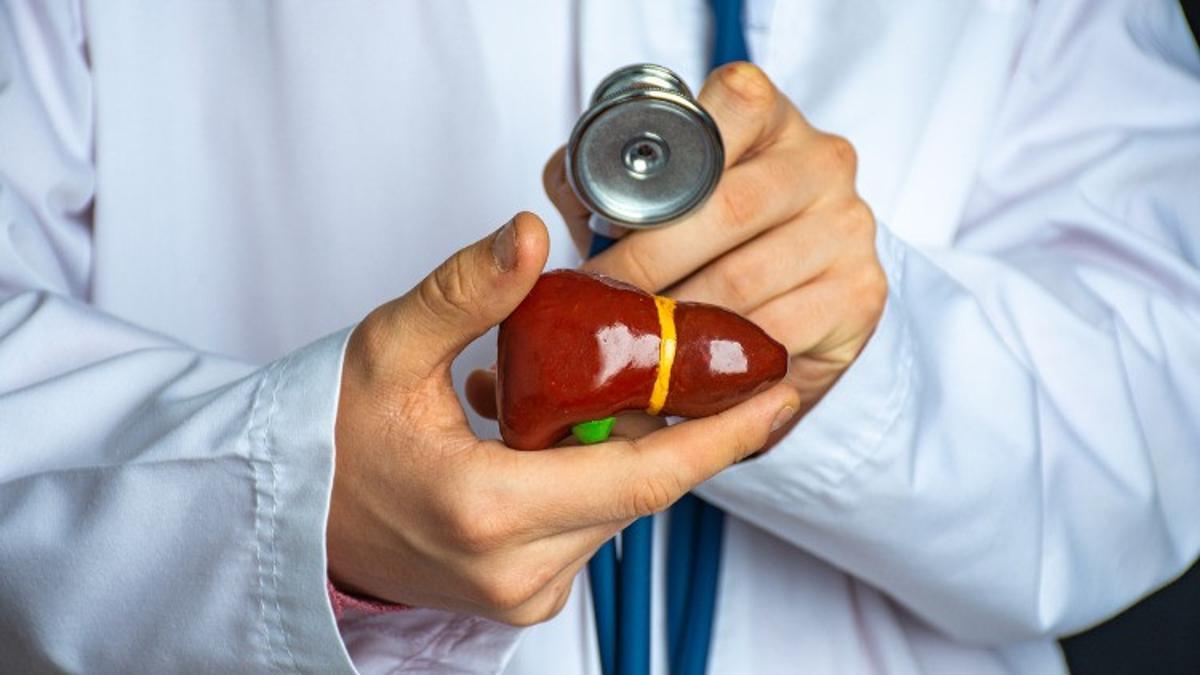 Siroz nedir, neden olur? Siroz hastalığının belirtileri ve tedavisi Siroz nedir, neden olur? Siroz hastalığının belirtileri ve tedavisi