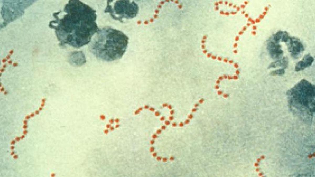 Strep A-related deaths in the UK reach 122