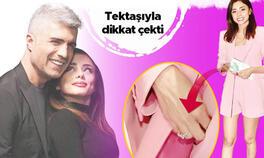 The ring has appeared Will Özcan Deniz and her lover Samar Dadgar get married?