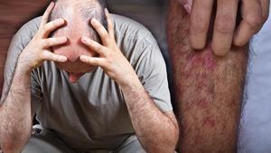 Covid-19’un az bilinen yan etkileri... Akciğer ve böbrekler dışında, şimdi de...