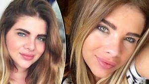 Damla Ersubaşı bir deri bir kemik kaldı