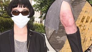 Gonca Vuslateri: Güneş ve deniz bana yasak