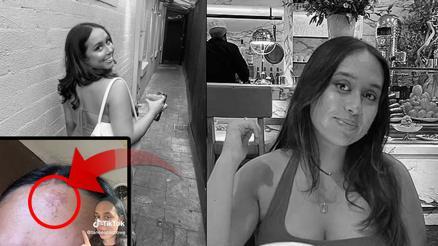 Alnındaki küçük bir yara yemek yiyemez hale getirdi, hastanelik oldu Bu virüse dikkat...