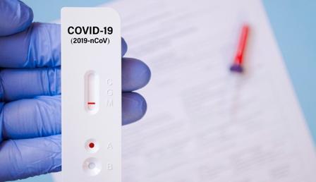 Covid-19 testim haftalardır pozitif çıkıyor… Virüsü bulaştırır mıyım?