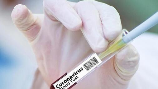 Son dakika haberi: Koronavirüs tedavisi için bir ilk yaşandı! Deksametazon ilacı...