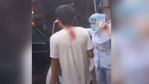Çin'de kafasına bıçak saplı adamın inanılmaz görüntüsü