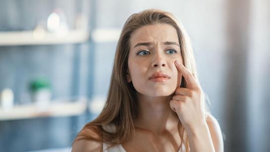 Sivilce neden olur, nasıl geçer? Sivilcelere iyi gelen yöntemler