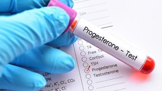 Progesteron Hormonu Nedir, Ne İşe Yarar? Progesteron Hormonu Yüksekliği ve Düşüklüğü Etkiler