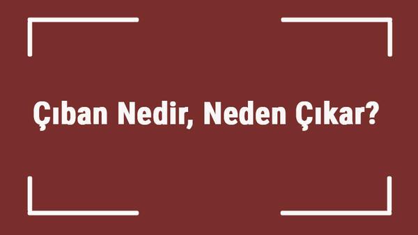 Yan ürün Niyet Tartışma Kor Ciban Nasil Olur Kapamak Diplomat Bağlantı