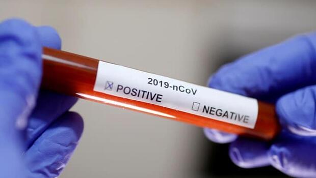 Yeni Zelanda'da ilk koronavirüs vakası tespit edildi