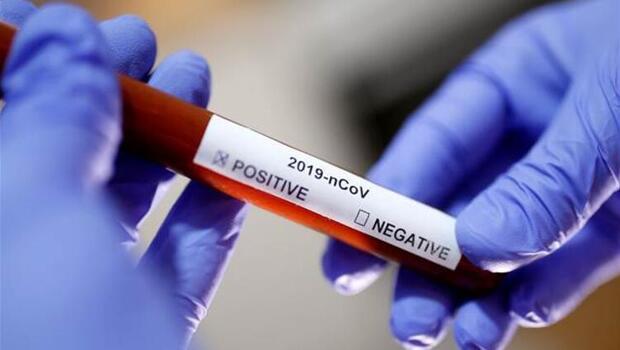 Corona Virüsü son dakika: Slovakya'da OHAL ilan edildi