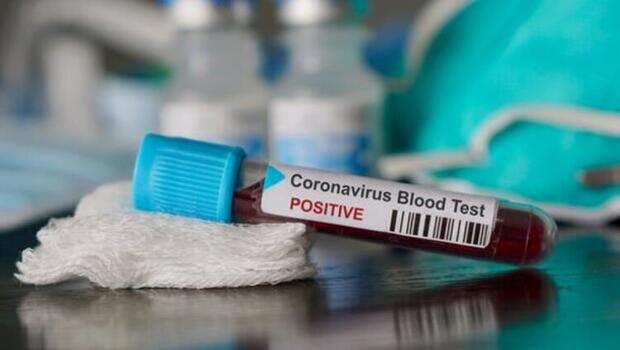 Koronavirüs vaka sayısı 5.5 milyonu geçti!