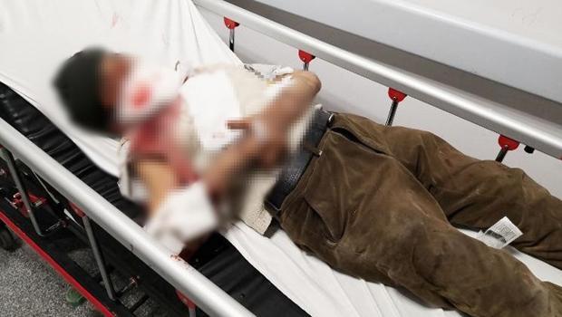 Misafirliğe gitti dehşeti yaşadı! Önce yüzünü, sonra vücudunu parçaladı