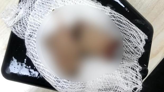 Şampiyonluk kutlamasında havai fişek elinde patlayınca parmakları parçalandı