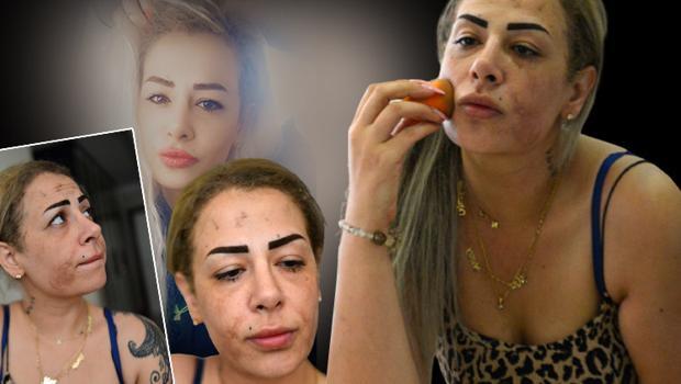 Güzellik merkezi hayatını alt-üst etti! Gelen cevapla ikinci şoku yaşadı