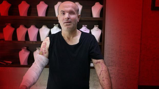 İzmir'de korkunç olay! Kuyumcuya kezzaplı saldırı... Kayıplara karıştı