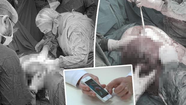 Şikayetleri 4 ay önce başlamıştı... Doktorlar da şaşkına döndü: Basketbol topu büyüklüğünde