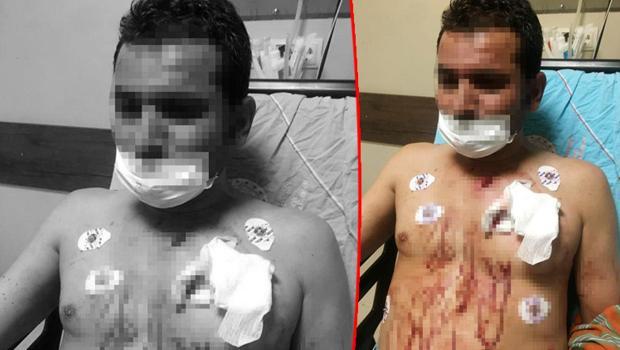 Uygunsuz fotoğraflarını paylaşmıştı... Erkek arkadaşını göğsünden bıçakladı