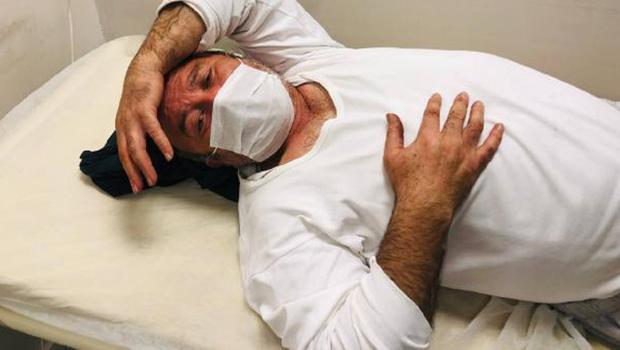 Evinin önünde ayı saldırısında yaralandı