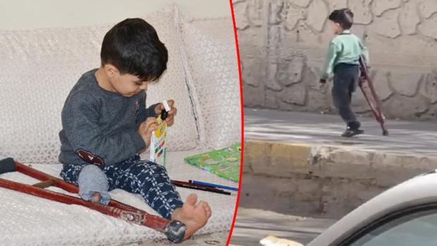 Görüntüleri sosyal medyada gündem olmuştu! Muhammet için protez bacak siparişi verildi