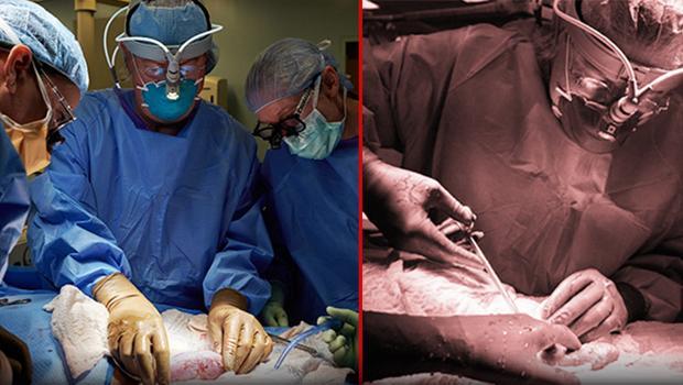 Tarihi operasyon başarılı! 'Birinin yaşaması için birinin ölmesi gerekmiyor'