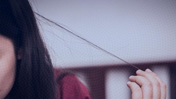 Bu hastalık saç baş yolduruyor! Karantina stresi yüzünden neredeyse kel kaldı