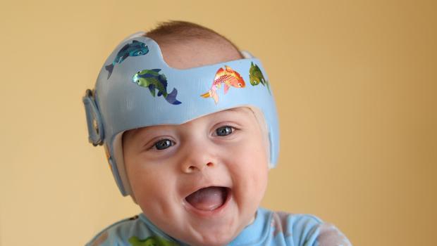 Çin'deki en son çılgınlık: Bebeklerine aylarca bu kaskı takıyorlar