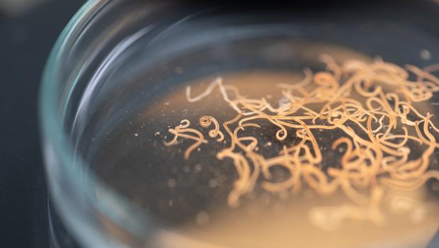 Yıllarca beyninde yüzlerce tenya ile yaşadı, gerçek o gece ortaya çıktı