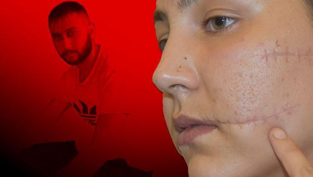 Birlikte yaşadığı eşini 104 yerinden bıçaklayan sanık: Eve geldiğimde kendini bıçaklıyordu