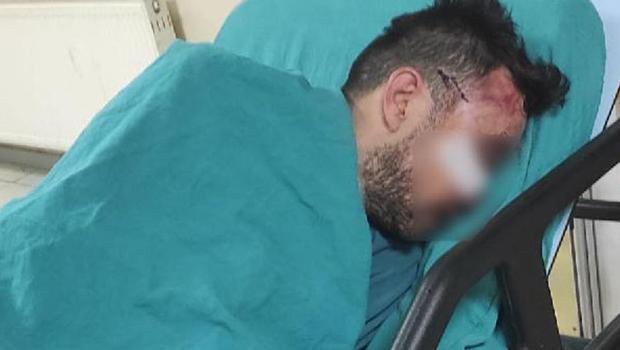 Zonguldak'ta iğrenç olay! Üniversiteliye taciz girişimine tekme tokat dayak