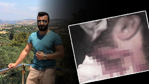 Doktoru boğazından jiletle yaralamıştı! 18 yıl hapis cezasına çarptırıldı