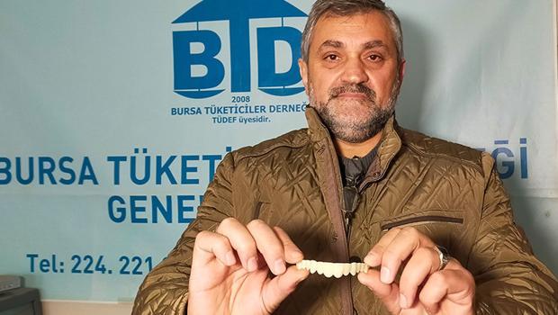 İnternetten diş protezi sipariş verdi! Kullanılmış plastik ürün geldi