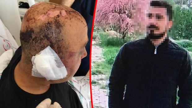 Polisi telsiziyle öldüresiye dövmüştü! İşte istenen ceza