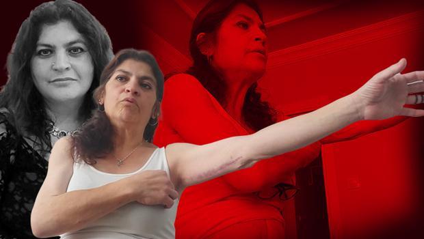 İzmir'de estetik kâbusu! Hayatı alt-üst oldu... Görenler şaşkına dönüyor