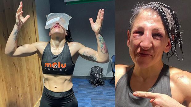 Son Dakika: Miriam Gutierrez tanınmaz hale geldi! 237 yumruk sonrası...