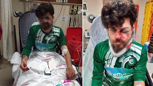 Yerde yatan rakibinin yüzüne tekme atıp yaraladı