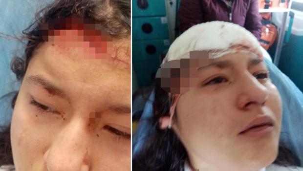 Öz çekim yapan çocuk köpeklerin saldırısına uğradı