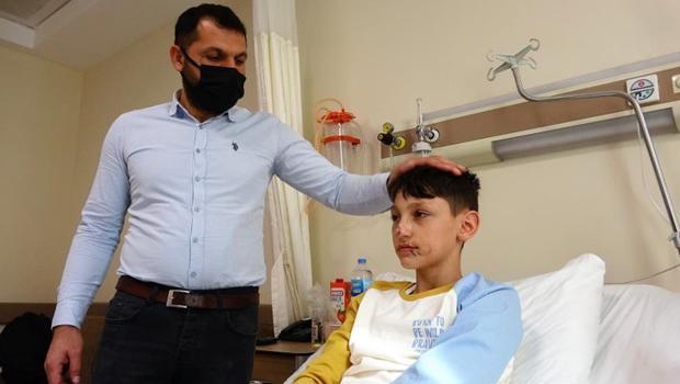 Minik Asiye gibi yüzünden yaralanan Berat’tan sevindiren haber