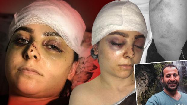 Sultangazi'de dehşet! Tayt giydiği için bu hale geldi, saldırgan serbest bırakıldı